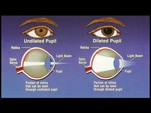 Pupil Dilation Infographic - Family EyeCare Center