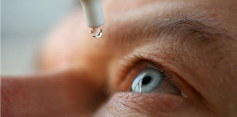 Managing dry eye disease 7