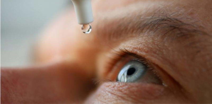 Managing dry eye disease 8 Managing dry eye disease 7