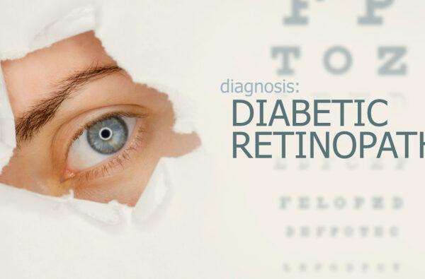 Diabetic Retinopathy