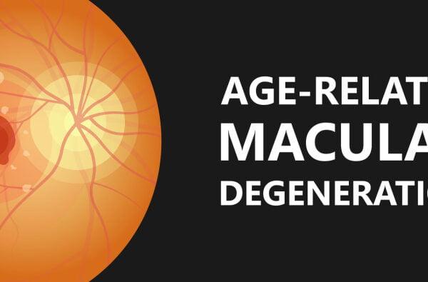 Age-related macular degeneration