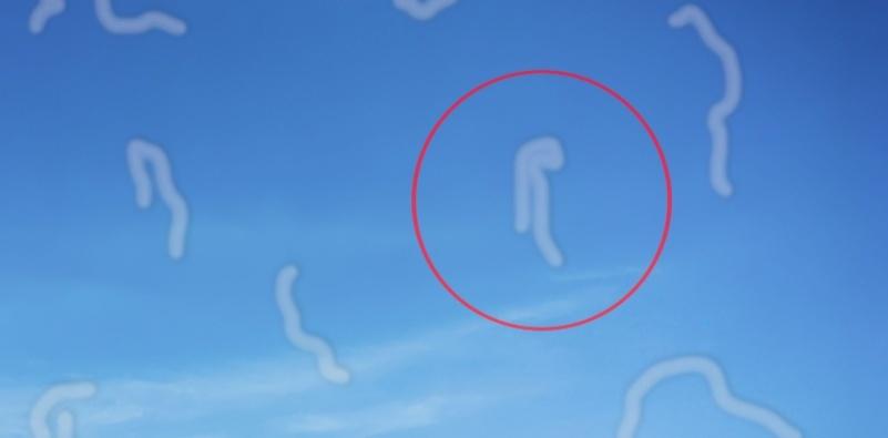What are eye floaters 1 Floaters